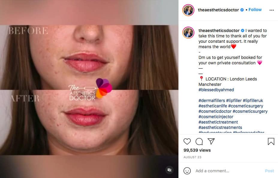 The Aesthetics Doctor is a social media sensation with his videos easily getting nearly 100,000 plays for before and after shots